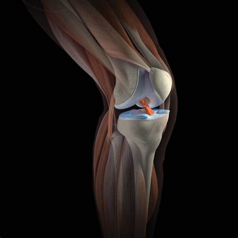 Коленный сустав - причины и лечение боли под коленом